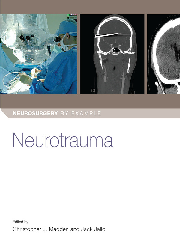  کتاب Neurotrauma