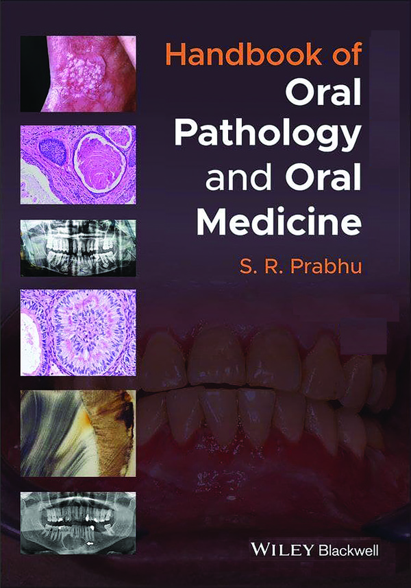  کتاب Handbook of Oral Pathology and Oral Medicine