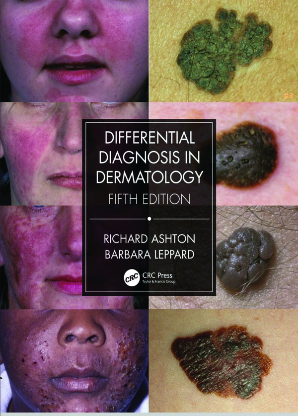 کتاب Differential Diagnosis in Dermatology