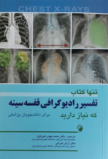 کتاب تنها کتاب تفسیر رادیوگرافی قفسه سینه که نیاز دارید;