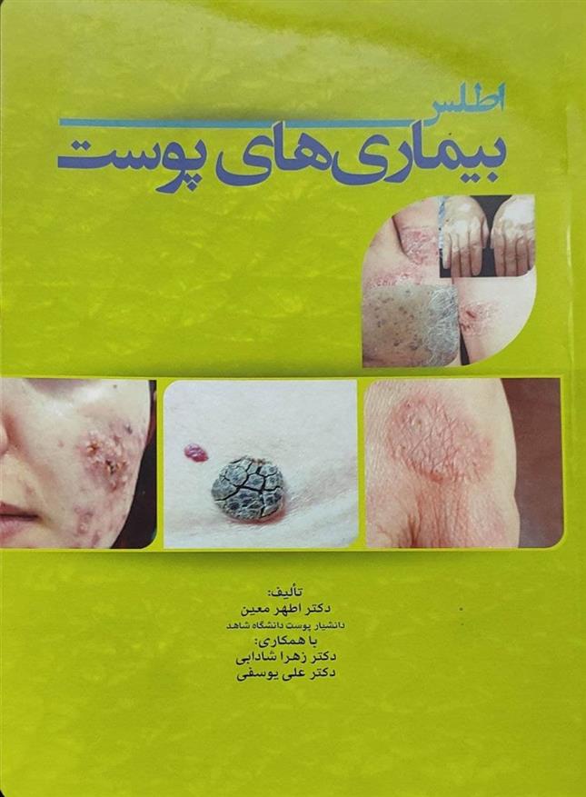 کتاب اطلس بیماری های پوست